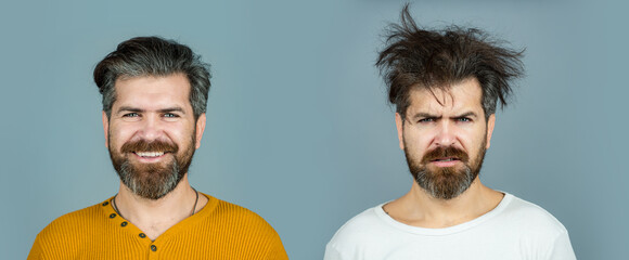 Man hair loss and problem hair. Hairs problems. Sad and happy. Haircare and loss hair problem....
