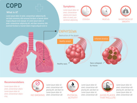 Infographic on chronic obstructive pulmonary disease, COPD, what it is, symptoms and recommendations with a graph of the effect on the lungs and corresponding icons.concept information COPD
