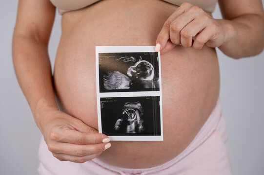 A pregnant woman holds a photo from an ultrasound screening against the background of a bare belly. 