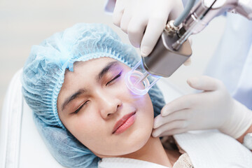 Side view of asian woman getting resurfacing laser fraxel dual and ultrasound face treatment in...