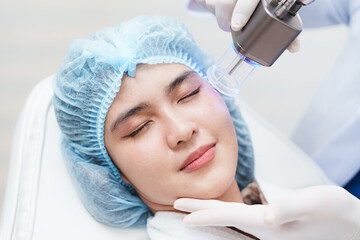Side view of asian woman getting resurfacing laser fraxel dual and ultrasound face treatment in...