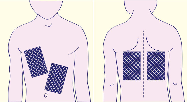 Back and chest with a mustard leaf. Retro picture.