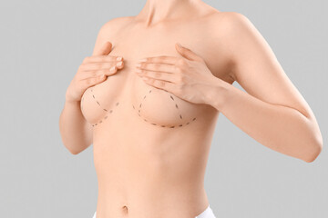 Young woman with marks on her breast against grey background. Plastic surgery concept