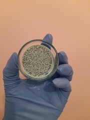 Isolate gram positive bacteria in the laboratory