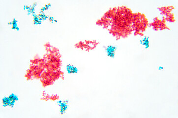Yeast cells, whole mount, 80X light micrograph. Stained smear of Saccharomyces cerevisiae, brewers...