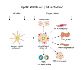 hepatic stellate cell (HSC) activation involving initiation and perpetuation processes. Hepatic fibrosis, liver fibrosis pathogenesis. Vector illustration. - obrazy, fototapety, plakaty