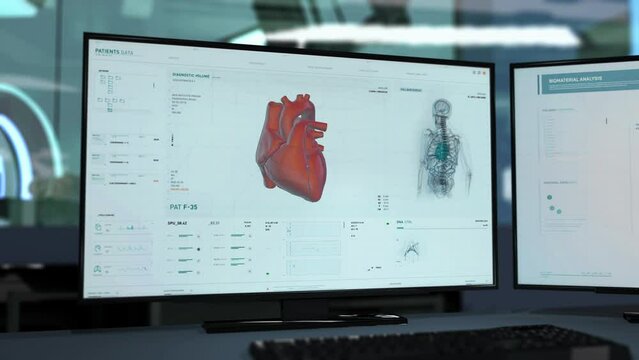 Performing heart artery examination at the health care facility. Examination of the arteries inside of the human heart. Examination software has found multiple blood clots in the arteries of a heart.