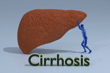 human holding big cirrhotic liver, 3D render