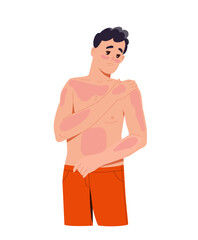 Fototapeta premium Sun burn person concept. Man with red spots at body. Young guy with skin problems and diseases. Graphic element for website. Cartoon flat vector illustration isolated on white background