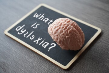 Medical and healthcare concept. Closeup image of human brain model and chalkboard with text WHAT IS...