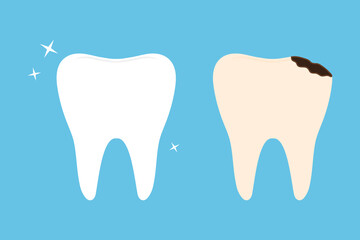 Healthy tooth and caries flat vector illustration