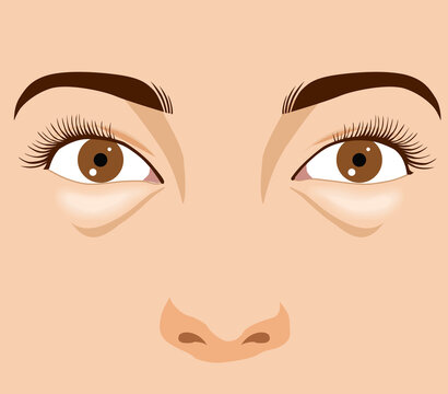 Puffy eye bag close-up of aging woman's face, illustration