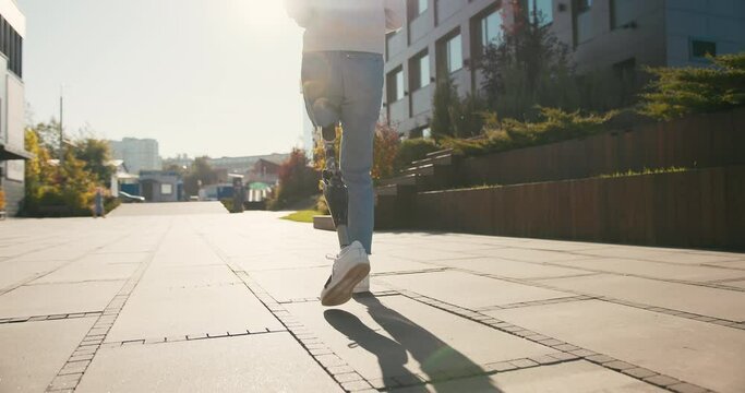 Young female student with prosthetic leg walking in university campus. Woman with bionic leg. Woman with leg prosthesis equipment