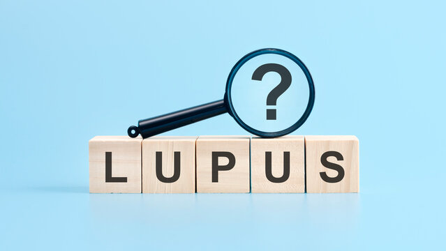 lupus word written on wood block. lupus text on table, concept.
