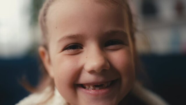 Portrait of smiling little girl missing two front teeth, children's dental care