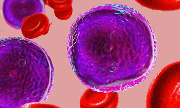 Acute lymphoblastic leukemia illustration on light pink background