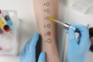Doctor doing skin allergy test at light table, top view