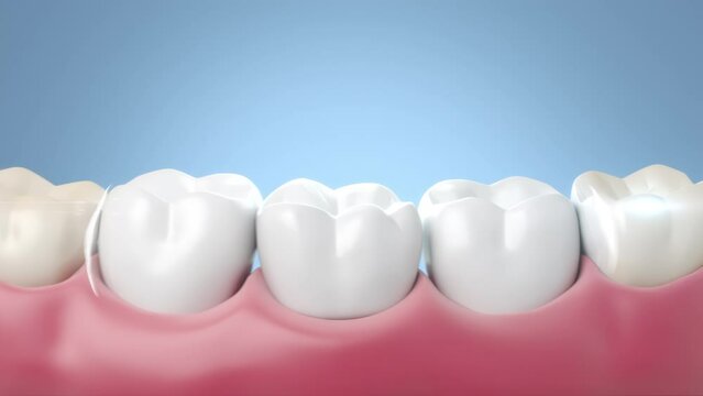 blue fluoride coating and cleaning teeth, Whitening tooth and dental health care 3d animation.