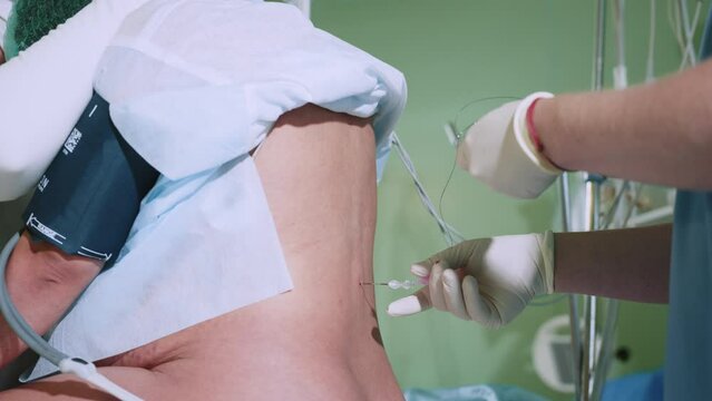Pain relief in preparation for surgery. Spinal anesthesia injection, epidural anesthesia or nerve block. Anesthesiologist at work. Doctor inserts a needle into the patient's spine for anesthesia
