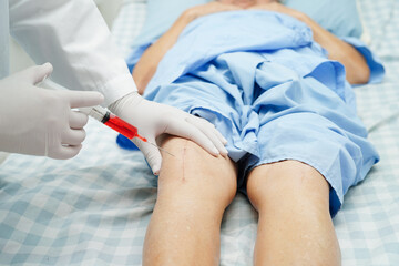 Asian doctor inject Hyaluronic acid platelet rich plasma into the knee of senior woman to walk without pain.