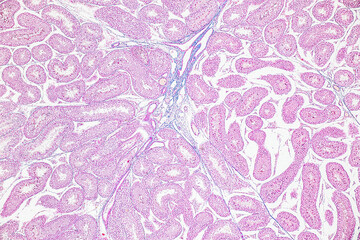 Backgrounds of Characteristics Tissue of Ovary rabbit and Tissue of Testis mouse under microscope.