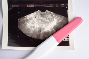 Pregnancy test with ultrasound scan of baby uterus, contraception health and medicine.