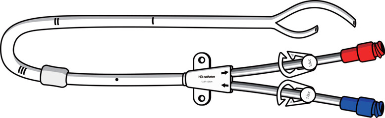 Cuffed catheter with split-tip  for hemodialysis