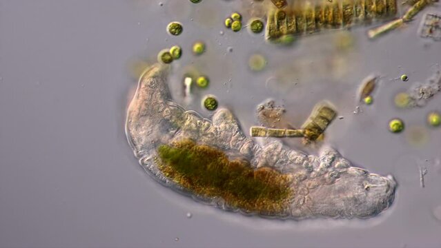 Tardigrade or water bear on grey background under the microscope