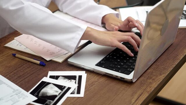 Doctor reviews test results looking at patient Electrocardiogram and ultrasound images and documents close up view