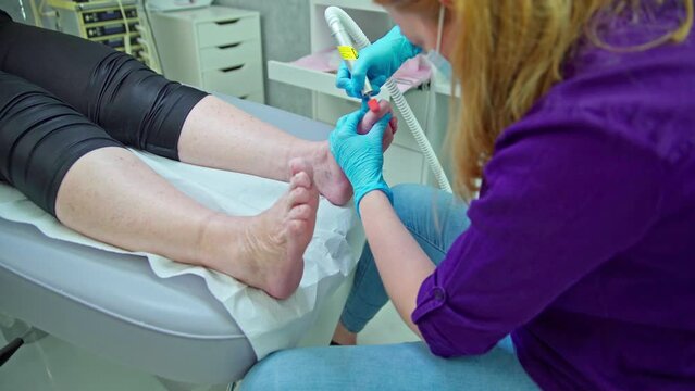 Removal of keratinized skin from the toes by a cosmetologist.