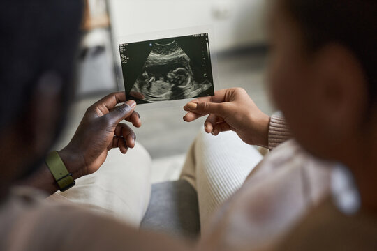 Close up of man and woman holding ultrasound picture together expecting baby, copy space