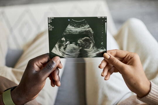 Close up of African American man and woman expecting baby and holding ultrasound picture together, copy space