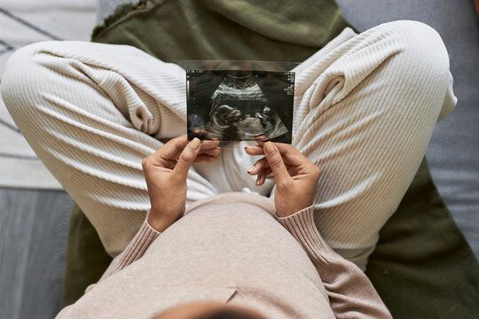 Top view close up of unrecognizable pregnant woman holding ultrasound picture of baby while sitting on bed, copy space