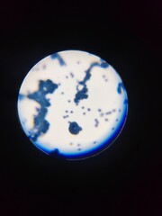 blood cells in microscope