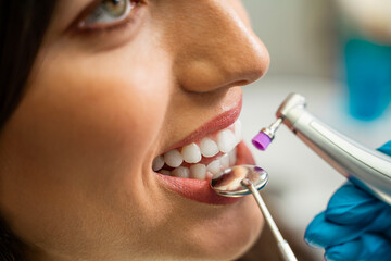 Closeup shot of teeth whitening procedure , young woman patient 