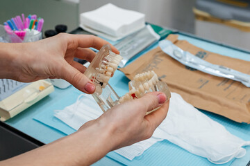 dentist shows the patient a model of the jaw and teeth