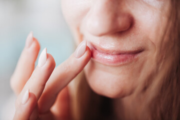 Woman using petrolatum on her mouth. Closeup lips background. Applying lip salve on lips with finger. Beauty background. Young girl skin care. Cosmetics for moisturize. Happy woman smile. - obrazy, fototapety, plakaty