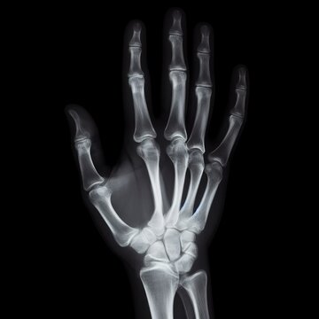 x ray of human hand isolated black