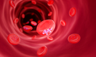 Malaria, Plasmodium malariae infection