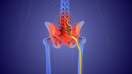 The medical concept of sciatic nerve pain	
