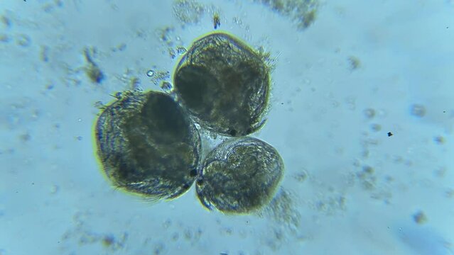 Water Fleas with Vorticellae and an Aquatic Worm