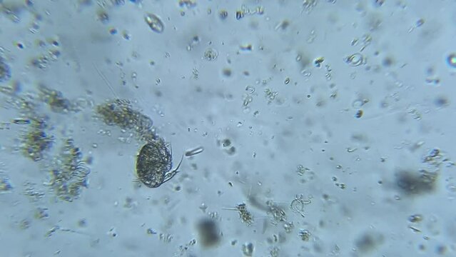 Nauplius - The First Larval Stage of a Crustacean Under the Microscope