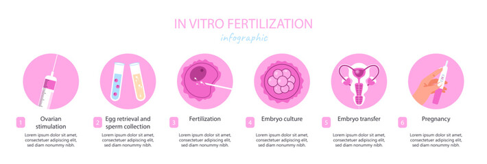 IVF infographic concept. Fertilization and ovulation. Reproductive system and health care. Gynecology, anatomy and biology. Cartoon flat vector illustration isolated on white background - obrazy, fototapety, plakaty