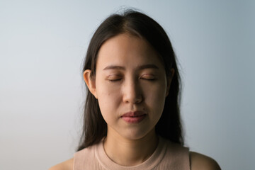 Asian woman with ongoing upper blepharoplasty surgery concept. Medical double eyelid plastic...