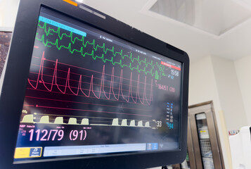 hospital monitor displaying vital signs: blood pressure, heart rate, pulse oximetry, and...
