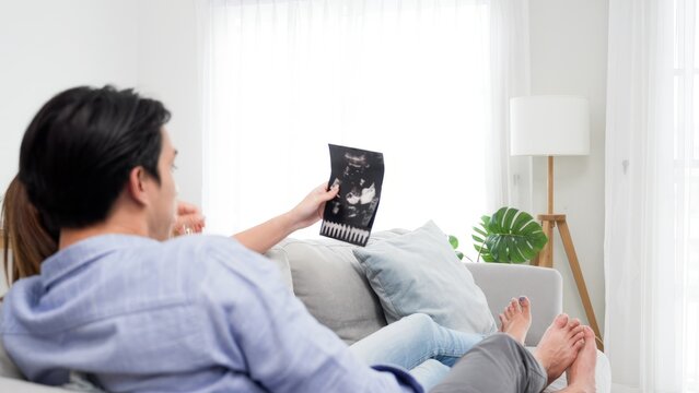Asian couple parent proud when see ultrasound baby image and waiting newborn in the future while sitting with love embracing on comfort sofa in the living room at minimal town home