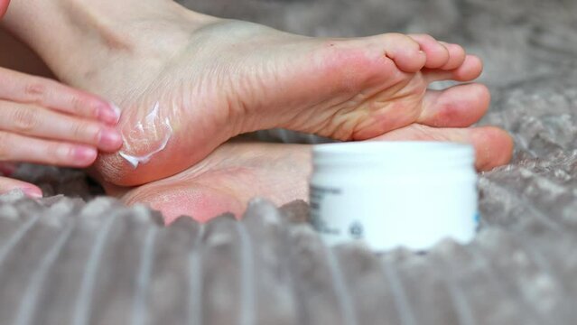 Moisturizing cream for dry, cracked skin. Foot care.