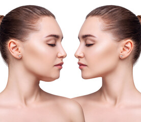Young woman before and after chin correction. Over white background.