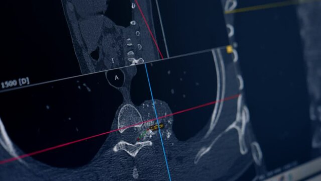 Hand of unrecognized doctor points at MRI scan with a pen. Analyzing patient's brain scan. Close up.