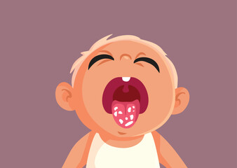 Little Baby Suffers from Candidiasis Vector Cartoon Illustration. Unhappy infant suffering from milk tongue or oral tush 
 - obrazy, fototapety, plakaty